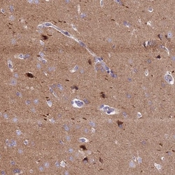 ANO3 Antibody, Novus Biologicals 0.1mL; Unlabeled:Antibodies, Polyclonal